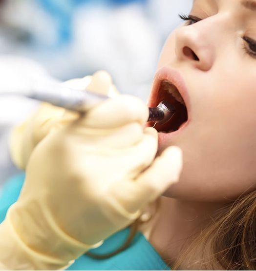 devitalizzazione denti a Lucca